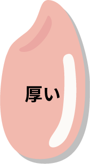 특징3